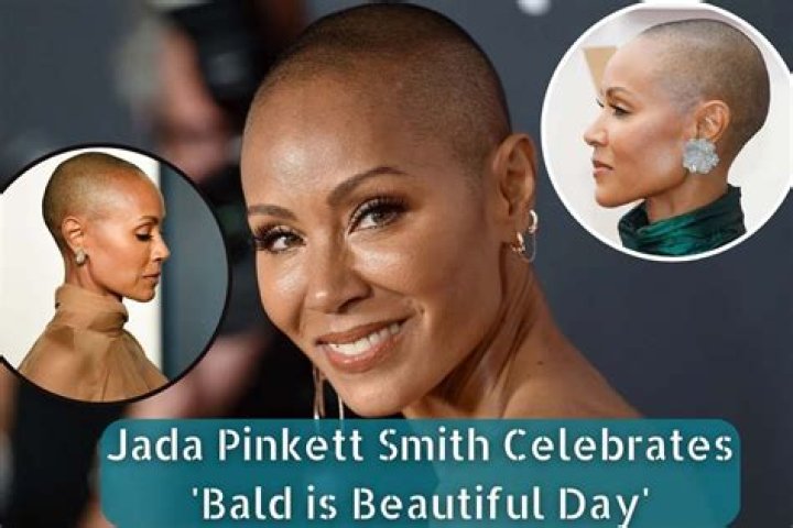Jada Pinkett Smith celebrates 'Bald Is Beautiful Day' on Instagram
