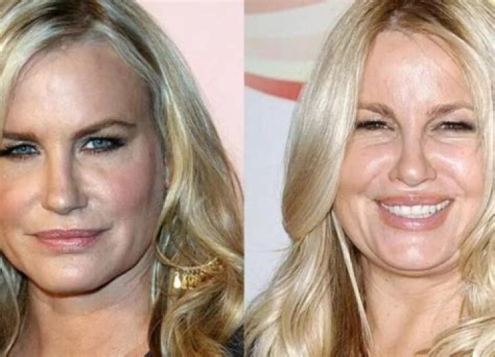 Jennifer Coolidge Plastic Surgery Examine the Before and After