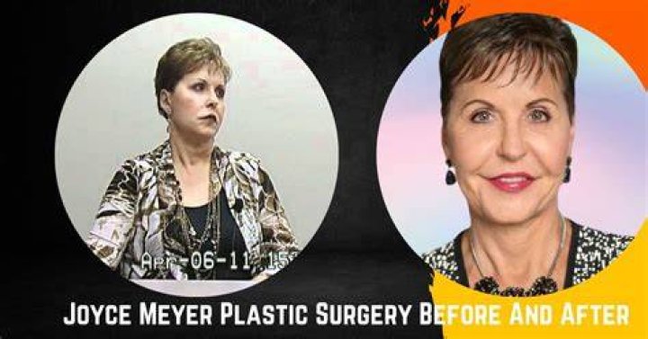 Joyce Meyer Plastic Surgery Before After celebrity plastic surgery