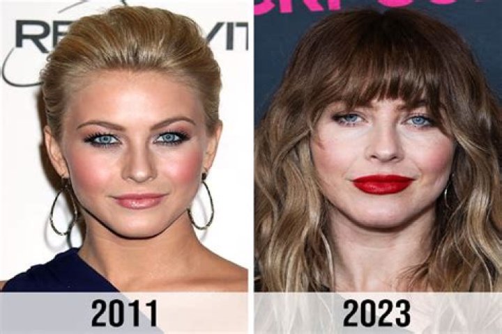 Julianne Hough before and after plastic surgery (3) Celebrity plastic