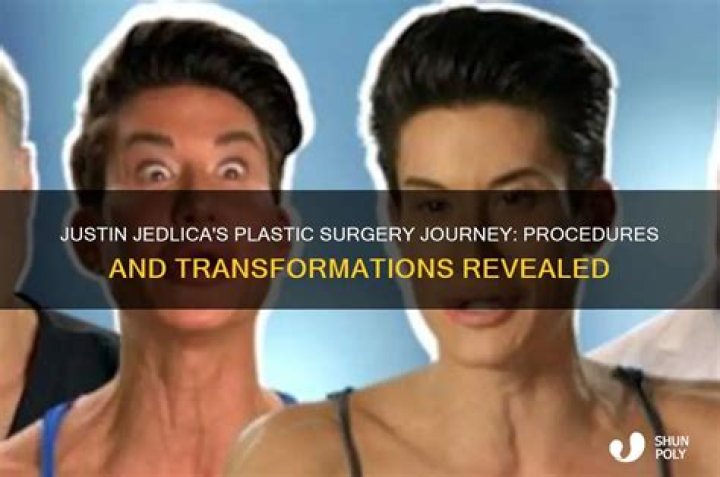 Justin Jedlica Husband Plastic Surgery Meet Human Ken Doll Partner