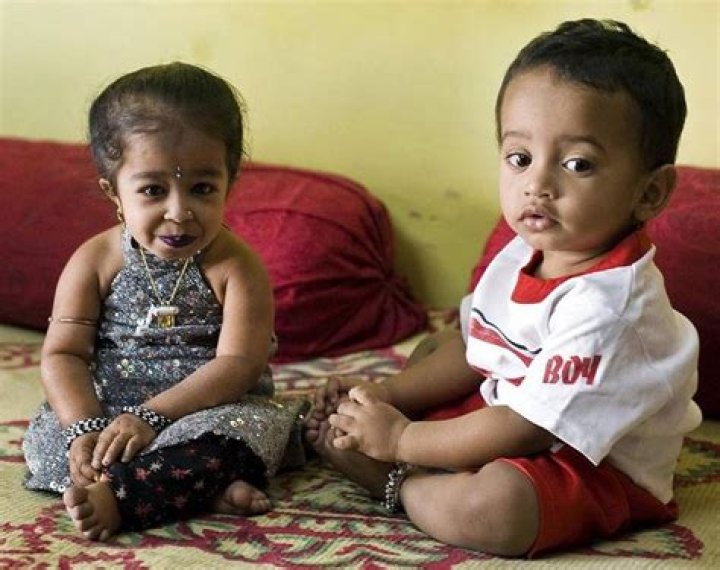 Jyoti Amge Baby