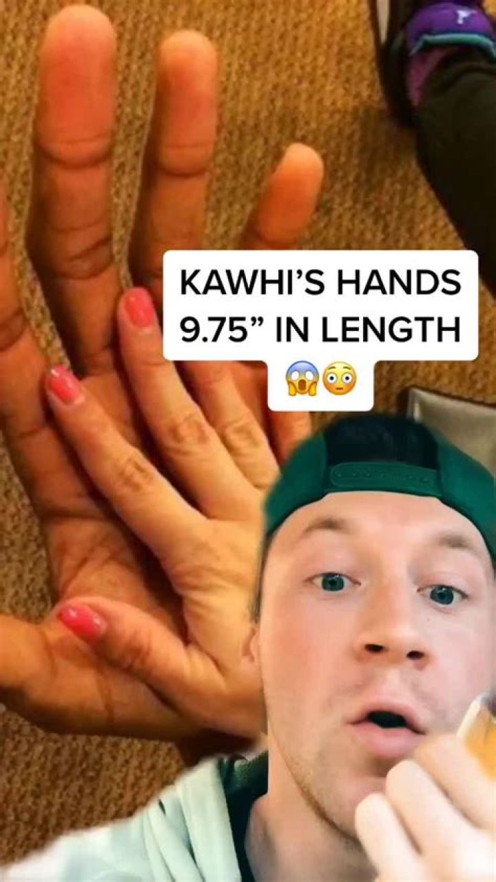 Kawhi Leonard&rsquo;s Hands r/BeAmazed