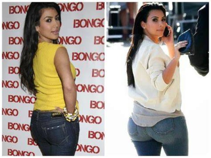 Kim Kardashian Plastic Surgery Butt