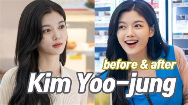 Kim Yoo Jung Plastic Surgery Kim YooJung Before And After 23136 명이 이