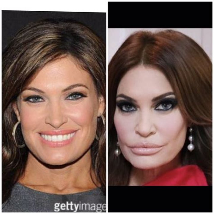 Kimberly Guilfoyle Plastic Surgery Before and After Photos NEWSTARS
