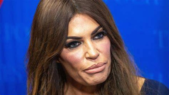 Kimberly Guilfoyle Plastic Surgery Did She Have Plastic Surgery For a