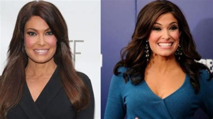 Kimberly Guilfoyle Plastic Surgery Facelift, Breast Enlargement, Botox