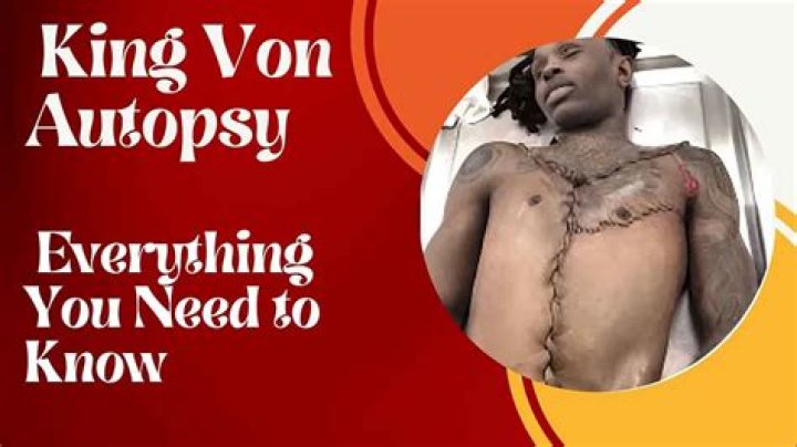King Von Autopsy Unraveling the Truth Behind the Tragedy
