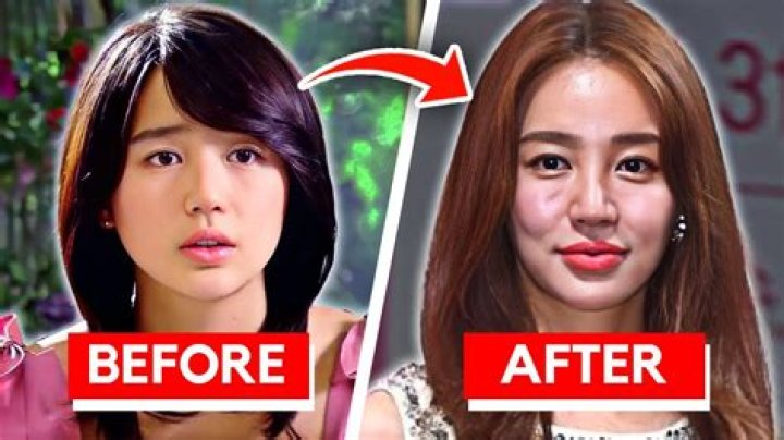 Korean Actresses Who Embraced Plastic Surgery: Transformations And Impact