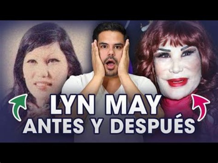 Lyn May Antes y despu&eacute;s de presumir su nuevo rostro Telemundo