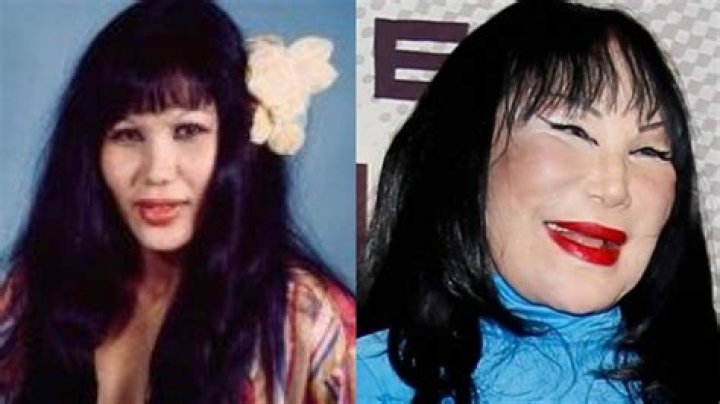 Lyn May Before And After Plastic Surgery