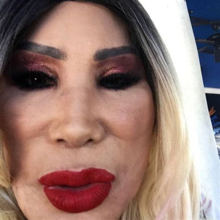 Lyn May revela la tragedia que vivi&oacute; en su rostro y recibe burlas en