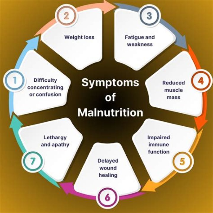 Malnutrition &lsquo;a slow violence against our children&rsquo; UCT News