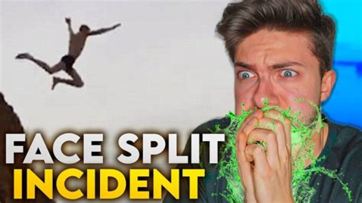 Man Splits Face Open Diving Video highpowertru