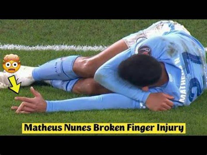 Matheus Nunes suffers horror injury UCL tie, photos of broken finger
