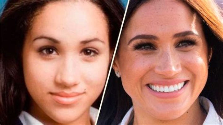 Meghan Markle Then and Now Photos of Her Transformation