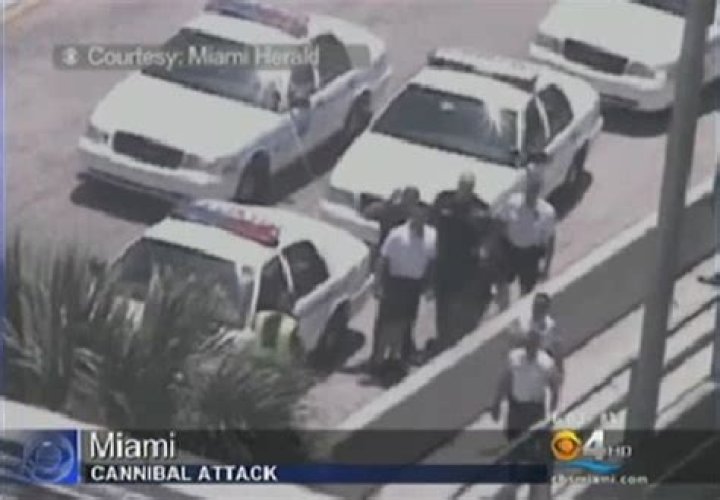 Miami Cannibal victim smiling again a year after losing eyes and nose