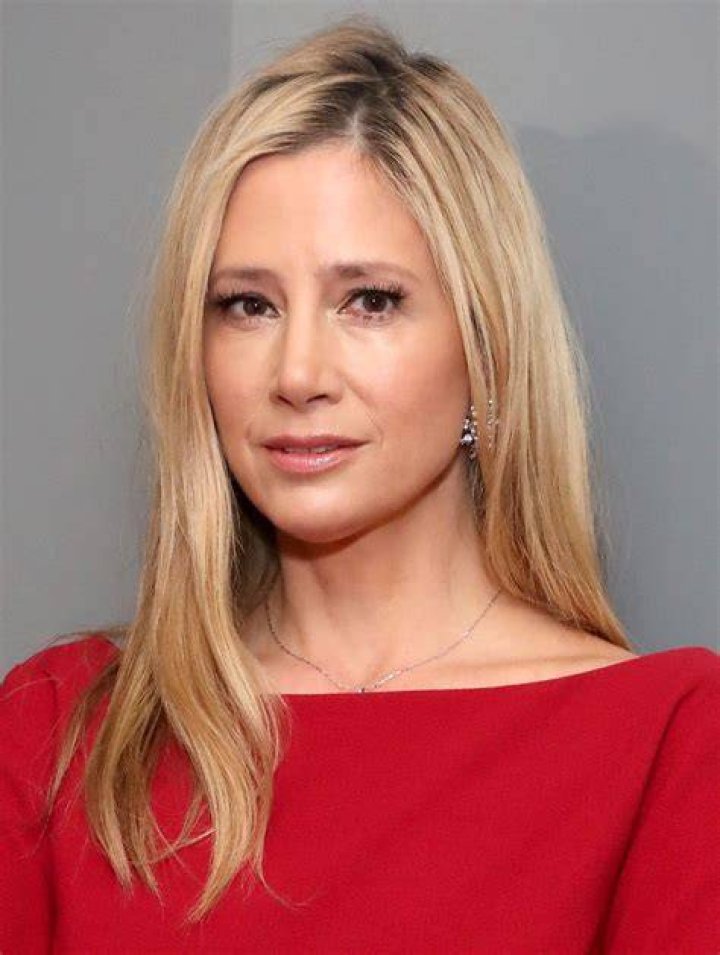 Mira Sorvino's Plastic Surgery Before and After Transformation Explained!