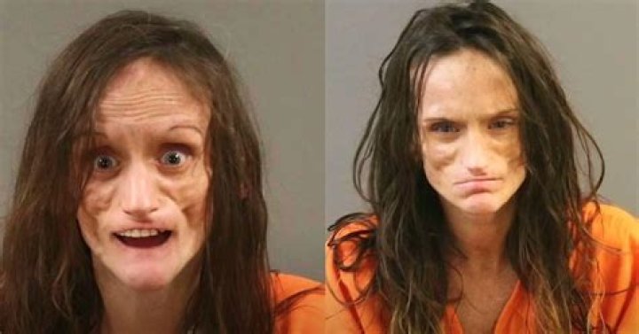 Misty Loman Now The Story of How She Reconstructed Her Life