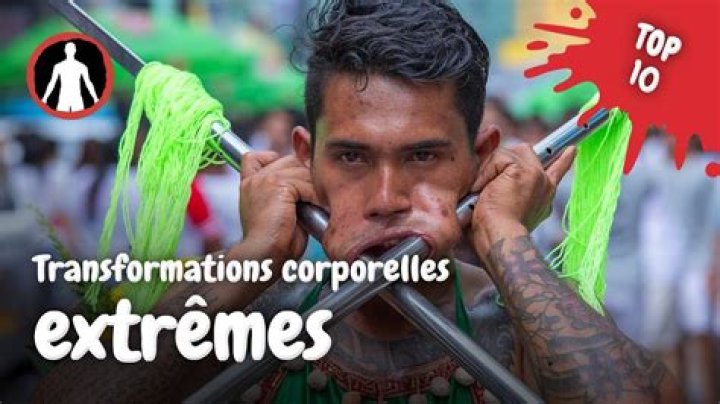 Modification corporelle extr&ecirc;me apr&egrave;s les oreilles, Black Alien se fait retirer le nez