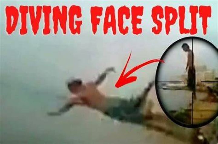 Open Diving Accident Face Split February 2024