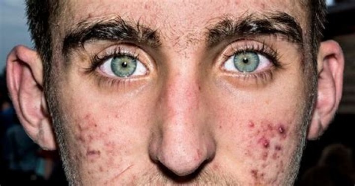 Painfully Close Photos Of Human Faces Look Strangely Inhuman HuffPost