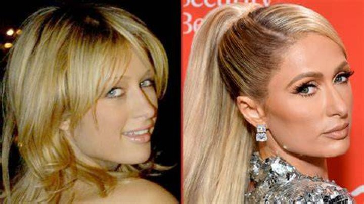 Paris Hilton Good Genes Or Good Docs?!