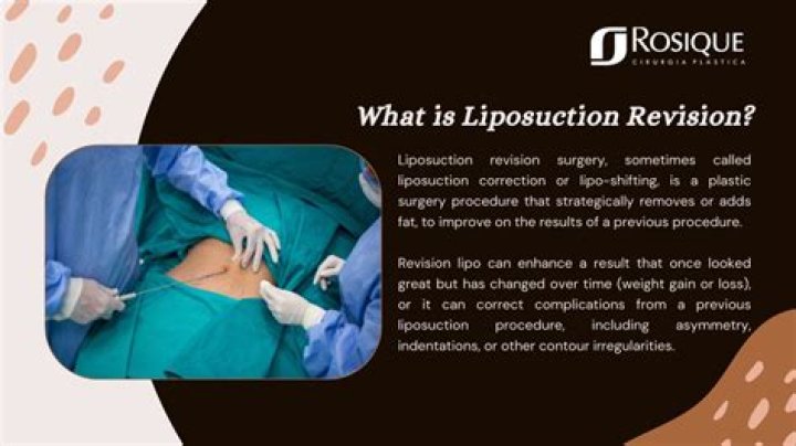 Patients Guide to Liposuction Revision Cosmetic Town