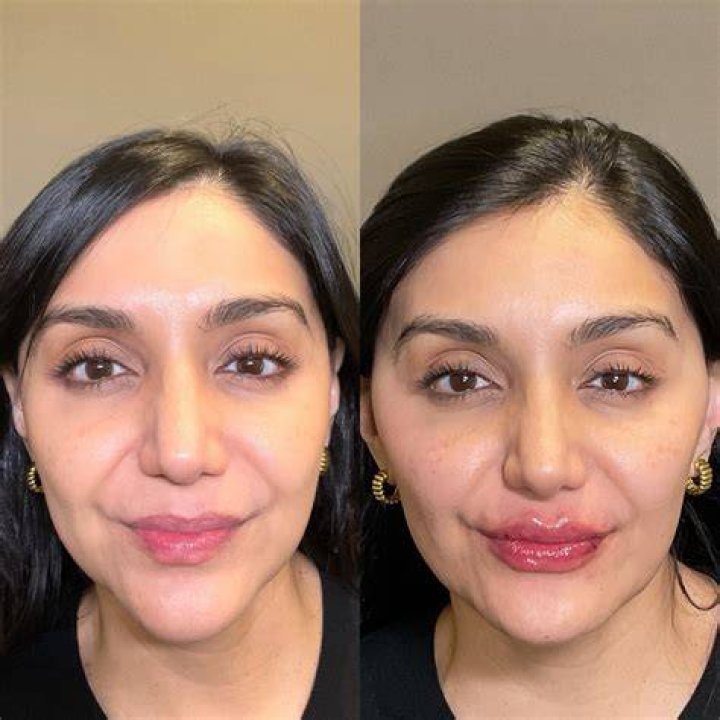 Pin on Before & After