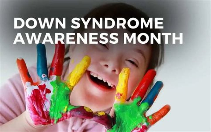 Pin on Celebrate Down syndrome