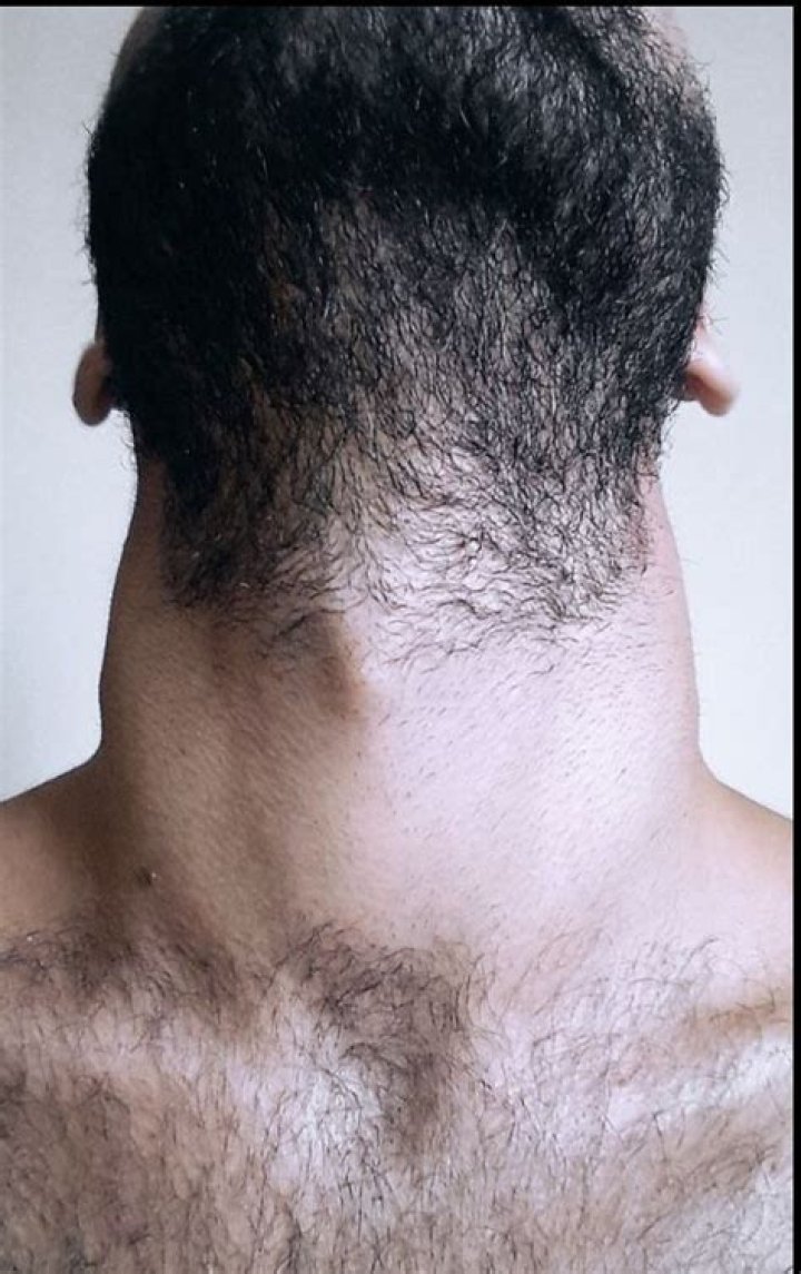 Pin on Hairy Men Neck Beard
