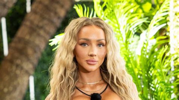 Plastic Surgery in Love Island A Close Up To Islanders Hair
