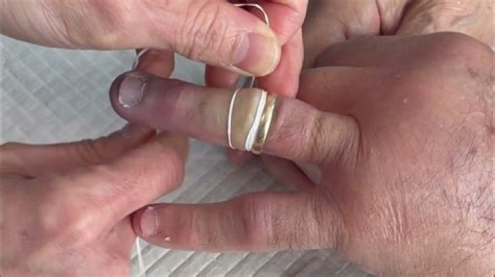 removing a ring with dental floss Yahoo Image Search Results Tip Of