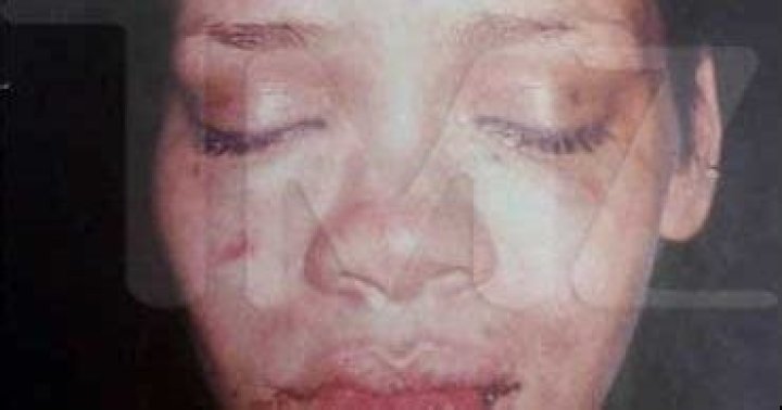 Rihanna Beat Up Face