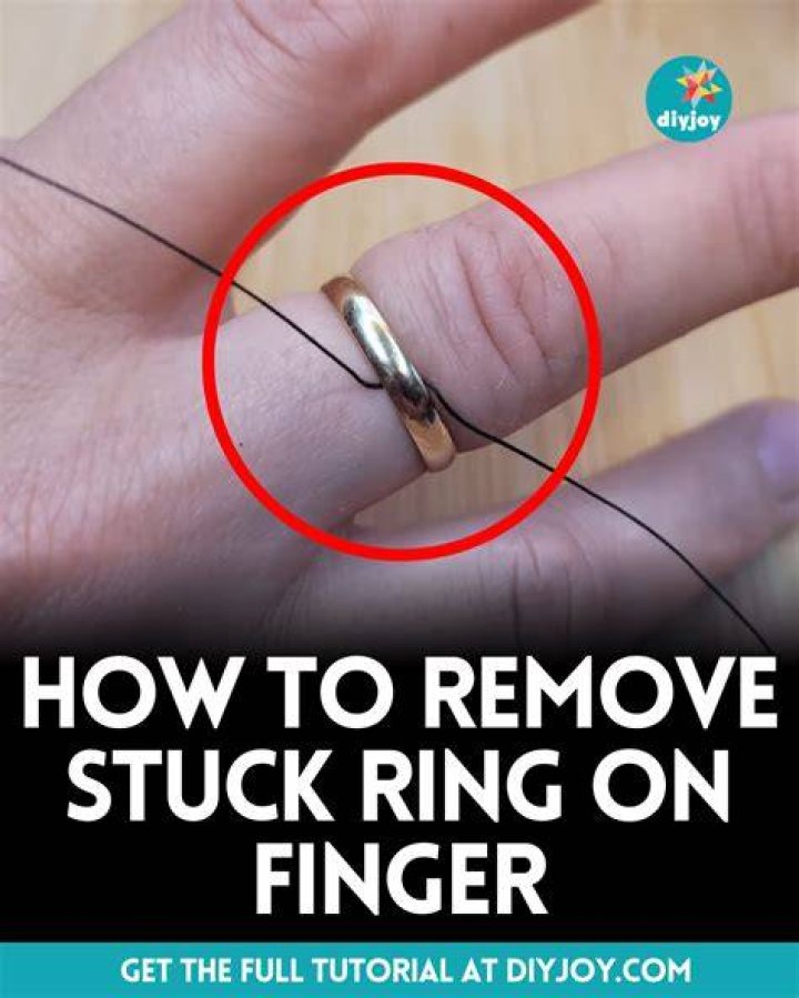 Ring Stuck On Finger? This Trick Could Save Your Finger And Your Ring
