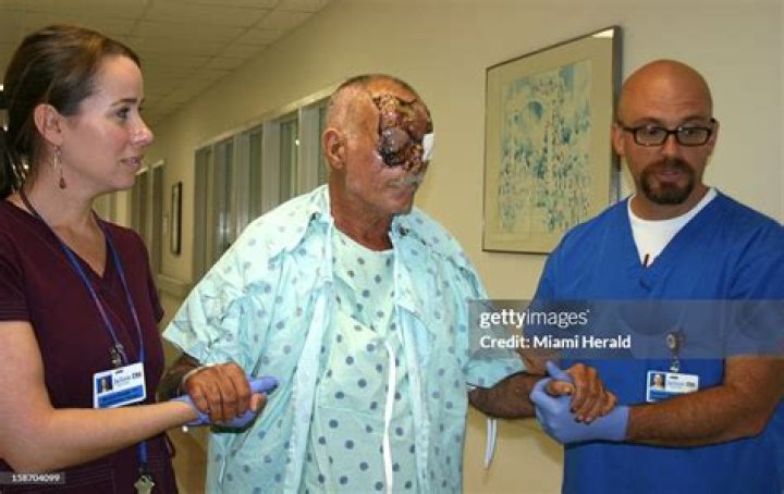 Ronald Poppo, Fla. facechewing victim, is in good spirits, doctors say