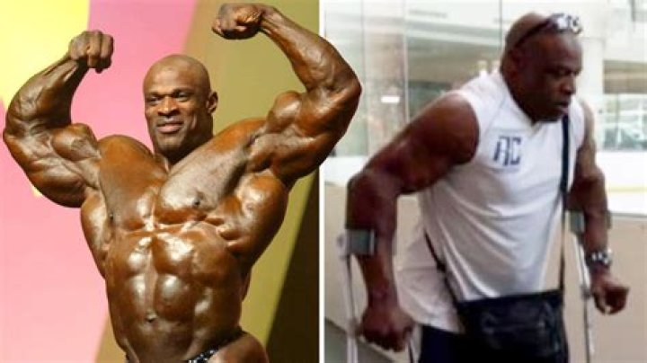 Ronnie Coleman Netflix documentary on Mr Olympia a cripple