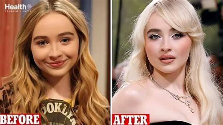 Sabrina Carpenter: A Transformative Journey Through Plastic Surgery