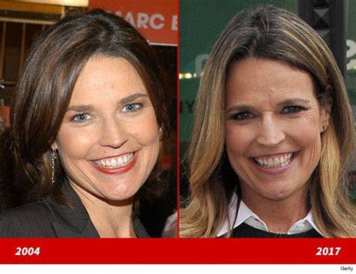 Savannah Guthrie Good Genes or Good Docs?