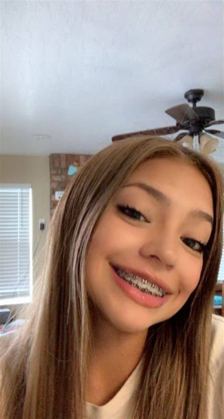 Skyleakss Braces Girl leaked viral video sparks controversy and online