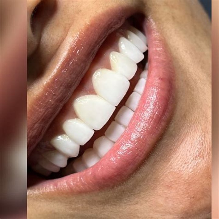 Sonreir con tranquilidad Dr Vargas Bogot&aacute; Colombia