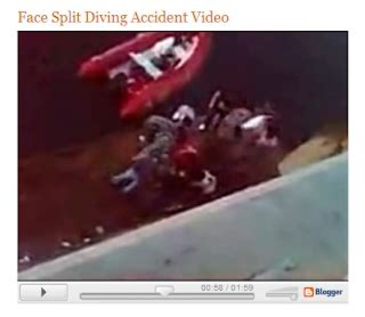 Split Face Diving Accident Video Face Split Diving Accident Video