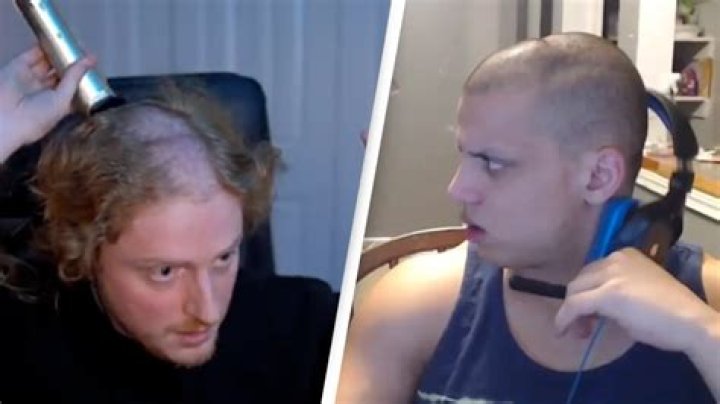 Streamers and gamers are noticing they have dents in their heads due to