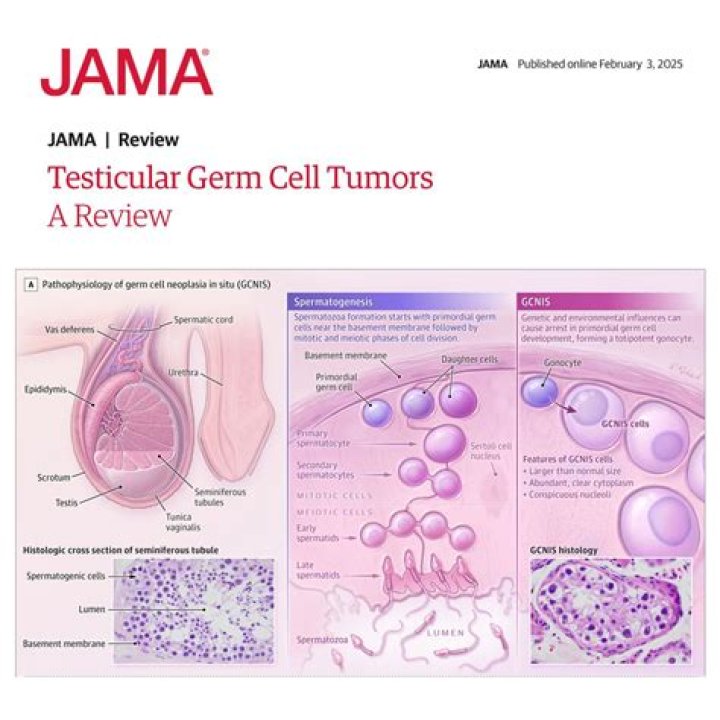 Testicular Mass Oncology JAMA The JAMA Network
