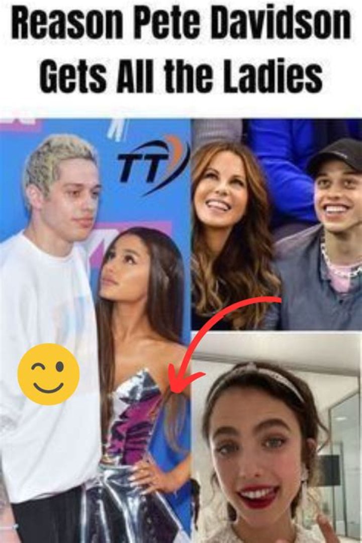 The Real Reason Pete Davidson Has Dark Lines Under His Eyes