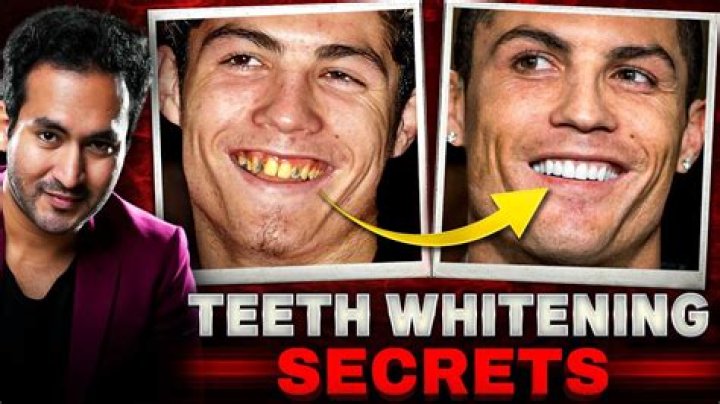 The Ultimate Guide To Achieving "World's Whitest Teeth": Discoveries And Insights