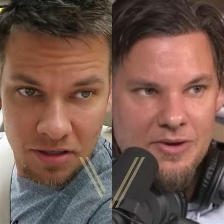 Theo Von Hair Transplant