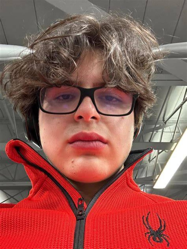These lines on my face (circled in blue) appeared after my bad reaction