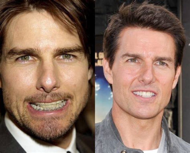 Tom Cruise Celebrity teeth before & after Digital Spy